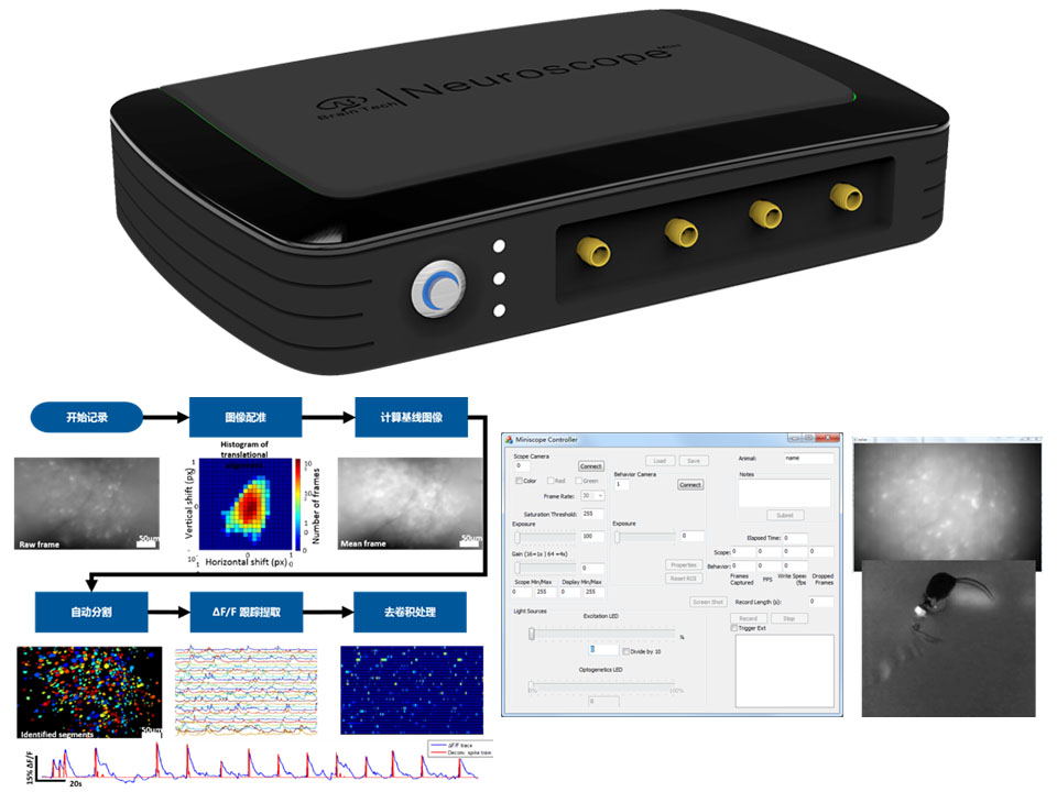 NeuroScope-超微型顯微成像系統(tǒng)